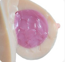 Gel